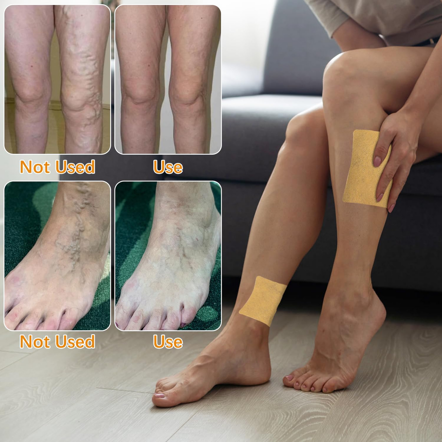 LiteLegs™ Varicose Vein Patch